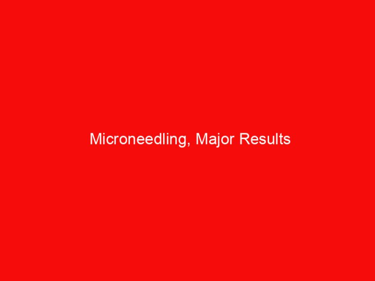 Microneedling, Major Results